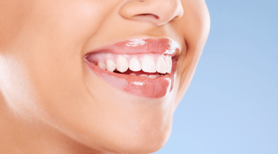 Beautiful smile tips